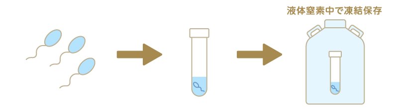 液体窒素中で凍結保存