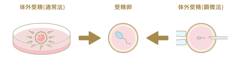 通常法と顕微法